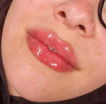 Lip Enhancement (Russian)