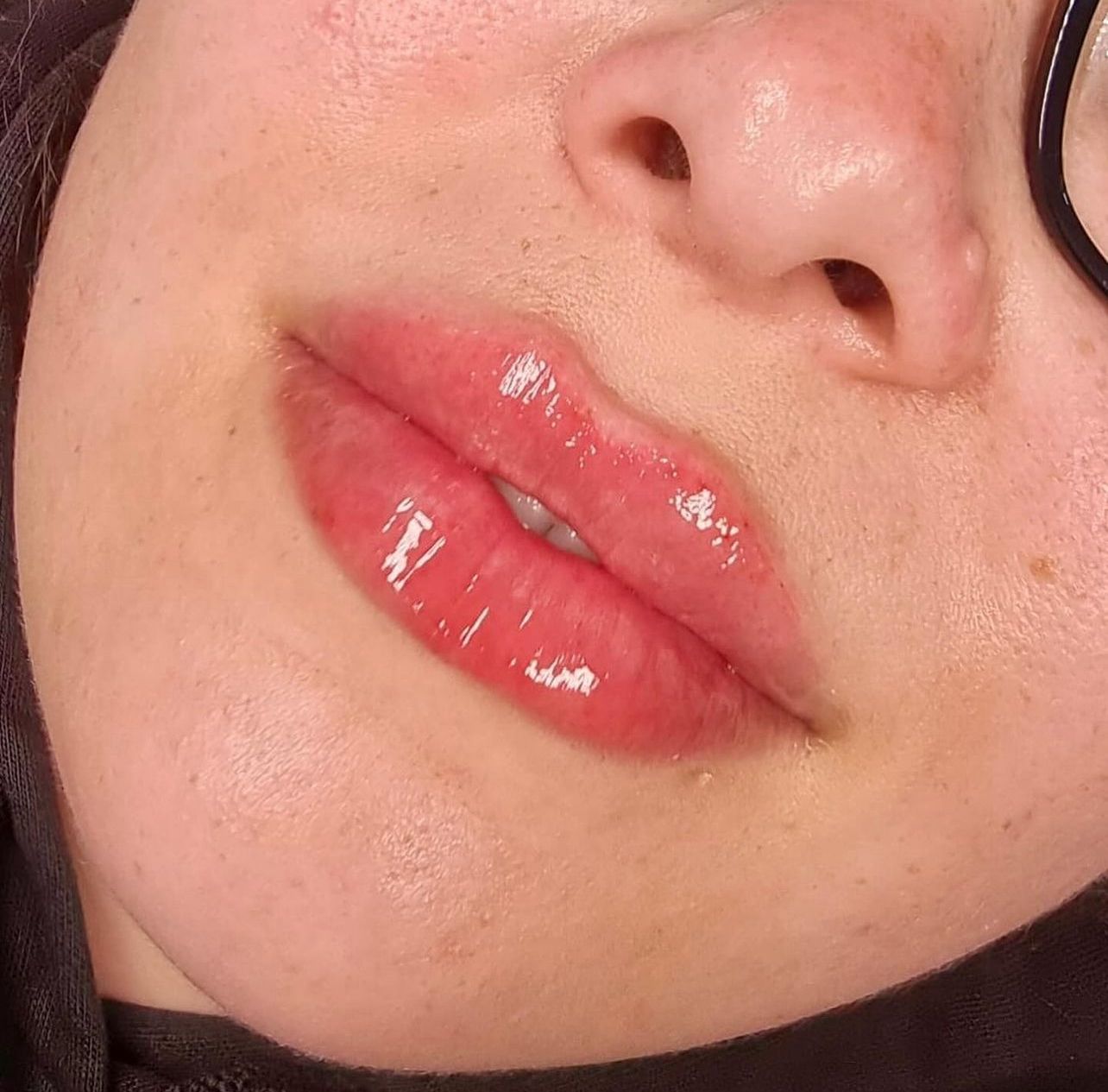 Lip Enhancement (Russian)