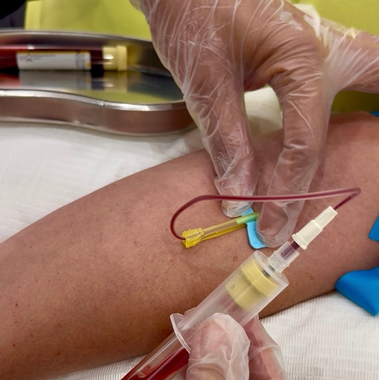 PRP – Any 1 Area of Concern