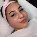 Derma 2.0 repair