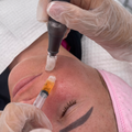 Derma 2.0 Exosomes