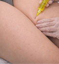 Fat Dissolving – Inner Thighs (Each Side)
