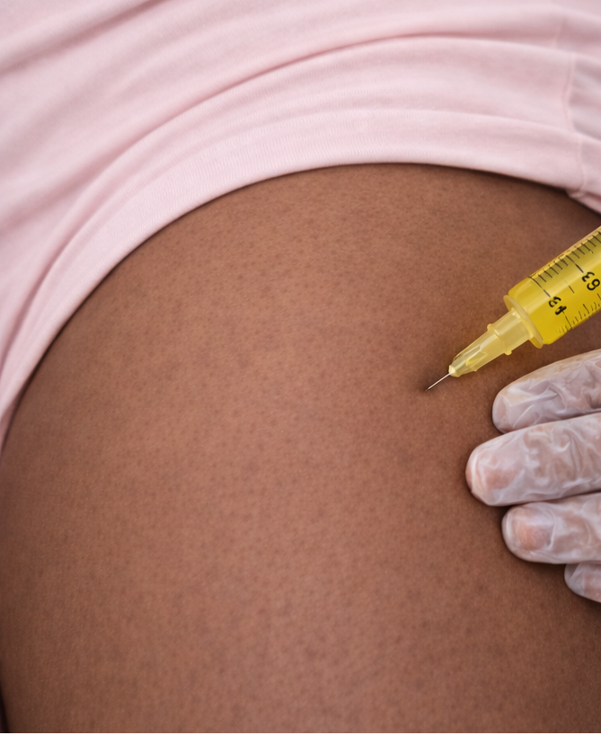 Fat Dissolving – Outer Thighs (Each Side)