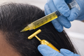 PRP – Hair Rejuvenation Treatment