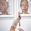 High Dose Vitamin C IV Drip