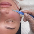 Dermaplaning Facial