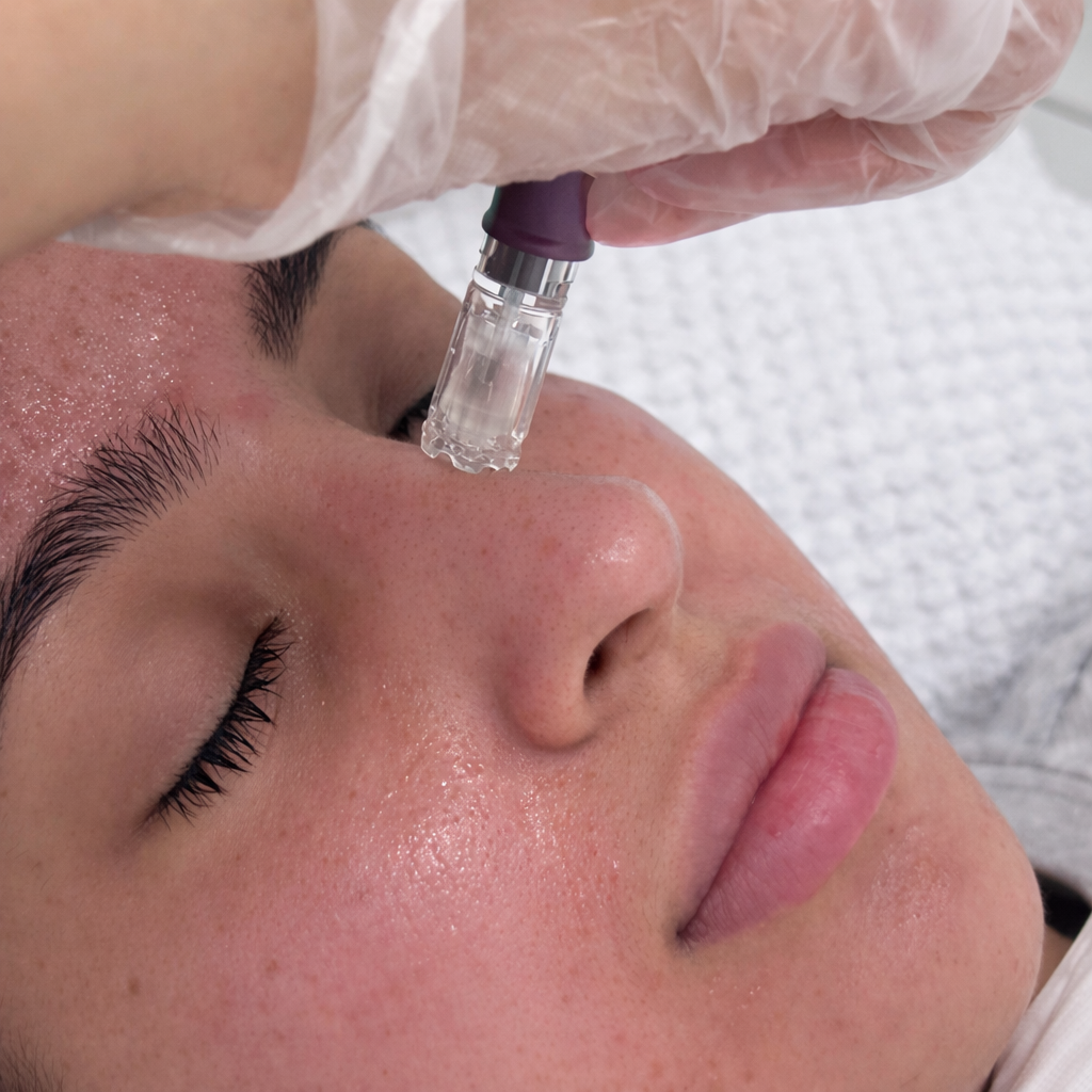 Hydrafacial and Microneedling