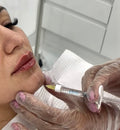 Chin Filler