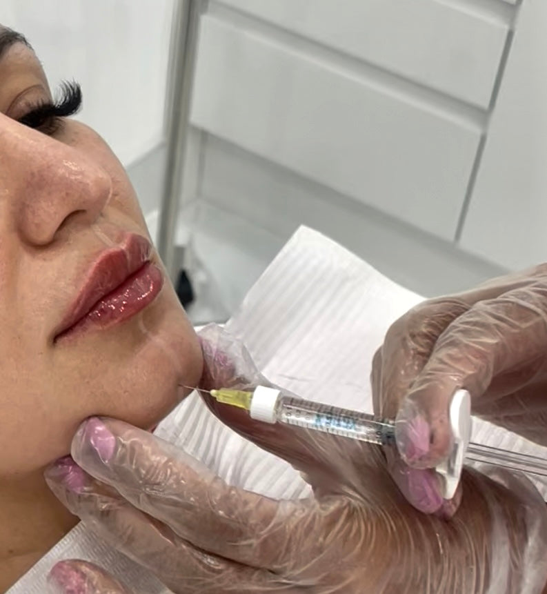 Chin Filler